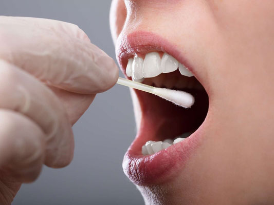 口腔咽頭サンプルの採取の場合